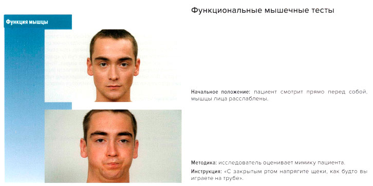 Функциональные мышечные тесты