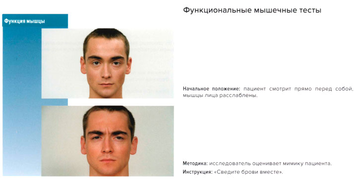 Функциональные мышечные тесты