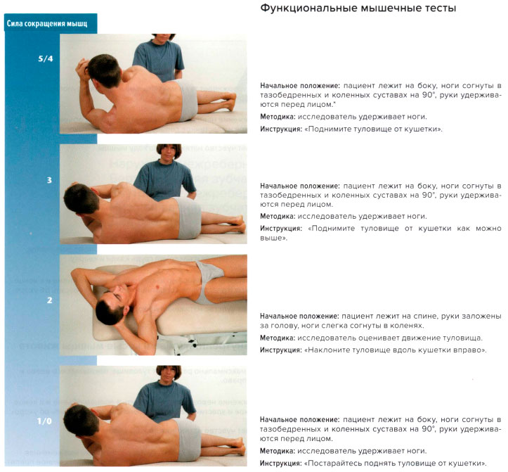 Функциональные мышечные тесты
