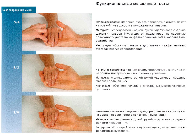 Функциональные мышечные тесты