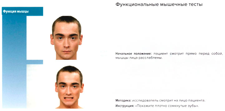 Функциональные мышечные тесты