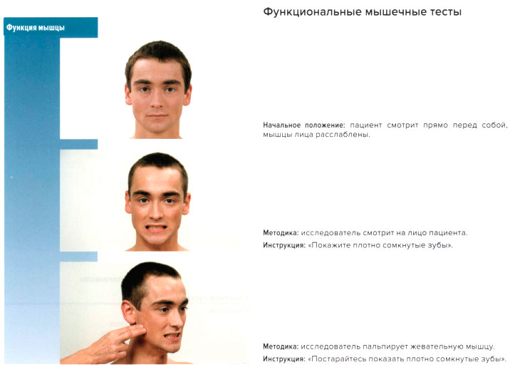 Функциональные мышечные тесты