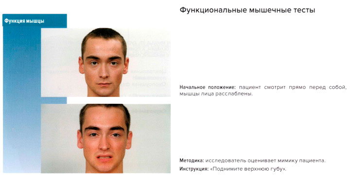 Функциональные мышечные тесты