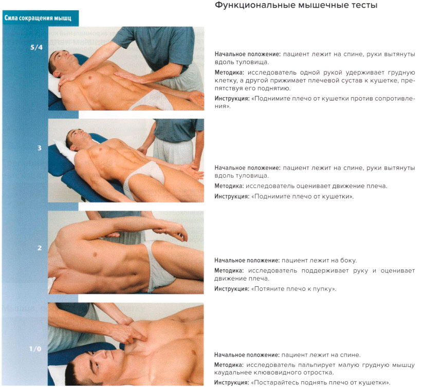 Функциональные мышечные тесты