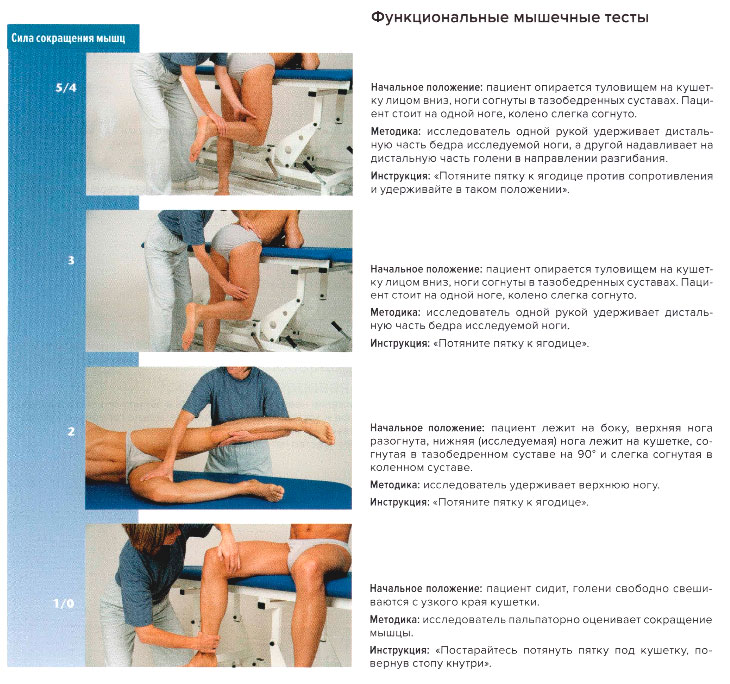 Функциональные мышечные тесты