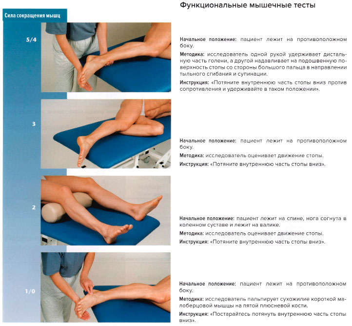 Функциональные мышечные тесты