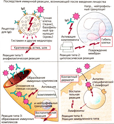 Последствия иммунной реакции, возникающей после введения лекарства