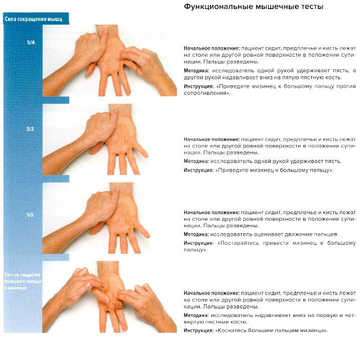 Функциональные мышечные тесты