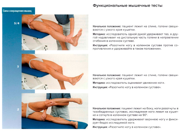 Функциональные мышечные тесты