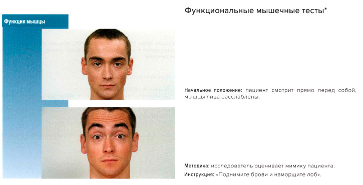 Функциональные мышечные тесты