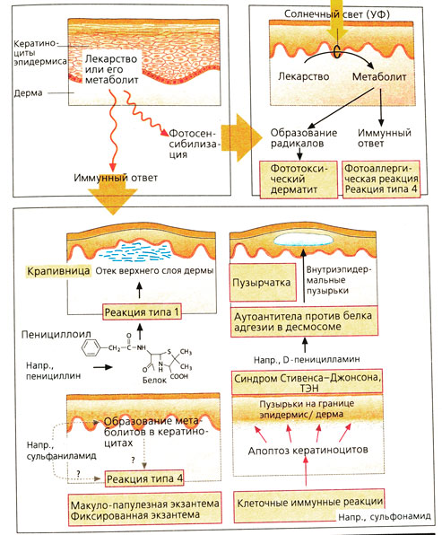 Нежелательные действия лекарственных препаратов: кожные реакции