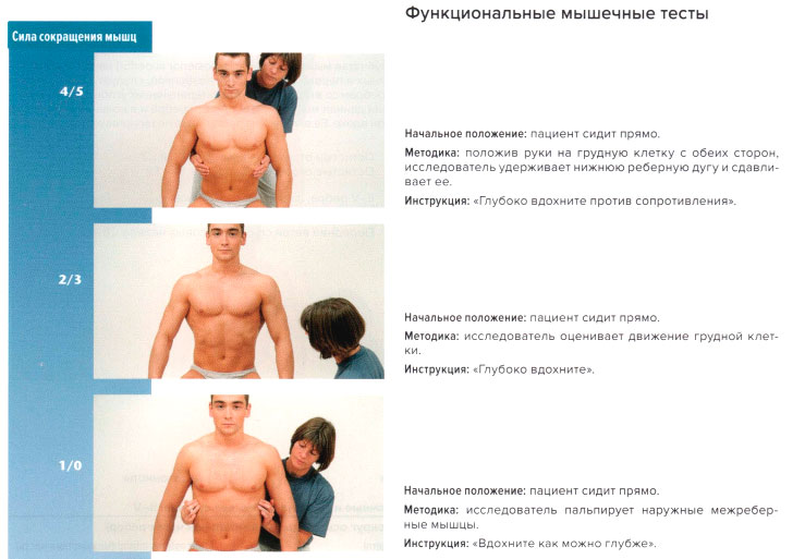 Функциональные мышечные тесты