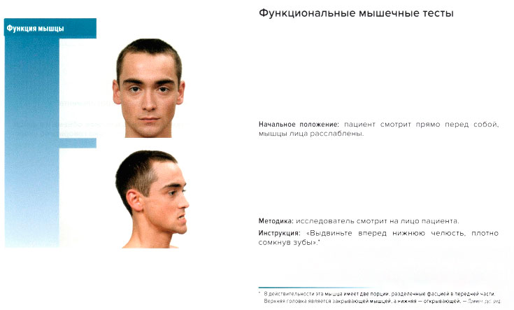 Функциональные мышечные тесты
