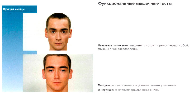 Функциональные мышечные тесты
