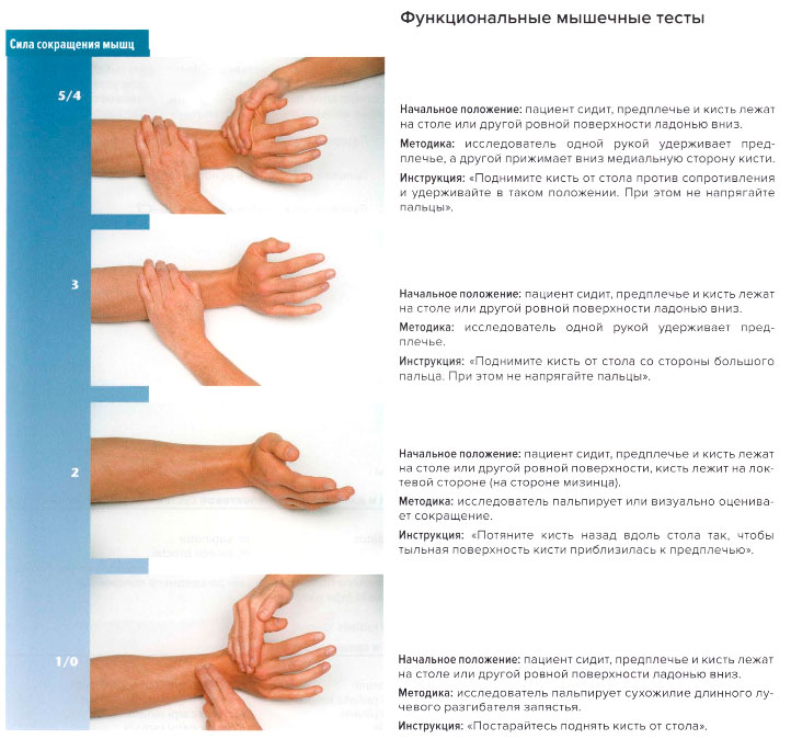 Функциональные мышечные тесты