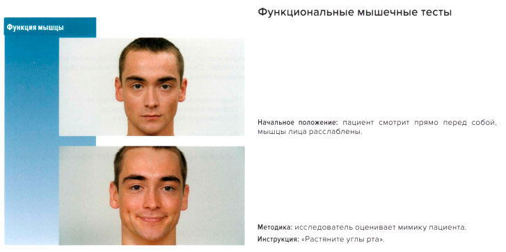 Функциональные мышечные тесты