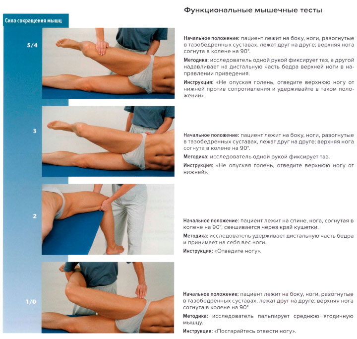 Функциональные мышечные тесты
