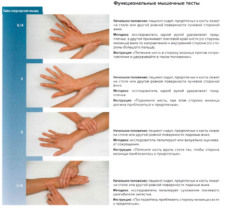 Функциональные мышечные тесты