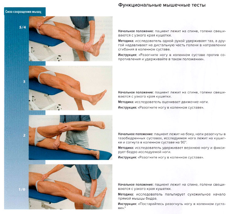 Функциональные мышечные тесты