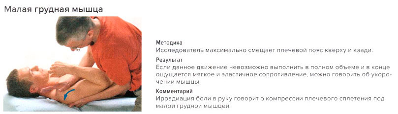 Стресс-тест малой грудной мышцы