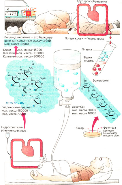 Заменители плазмы
