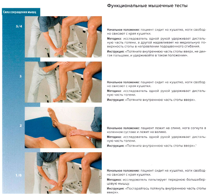 Функциональные мышечные тесты