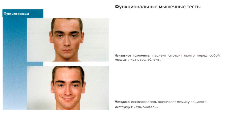 Функциональные мышечные тесты