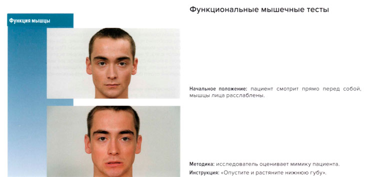 Функциональные мышечные тесты