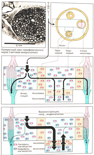 А. Местные анестетики в периферическом нерве