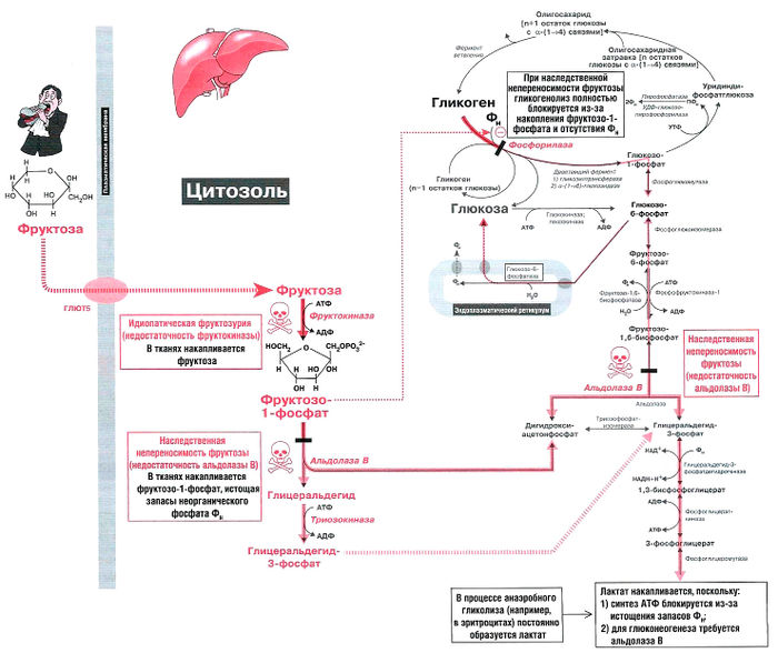 Рис. 22.3. Нарушения метаболизма фруктозы