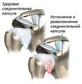 Humeroscapular.jpg