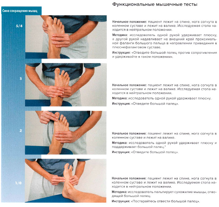 Функциональные мышечные тесты