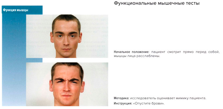 Функциональные мышечные тесты