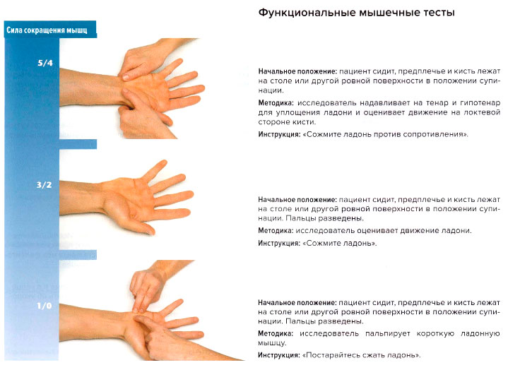 Функциональные мышечные тесты