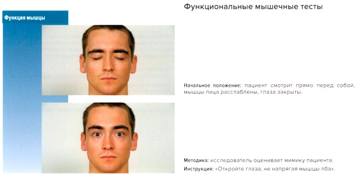 Функциональные мышечные тесты