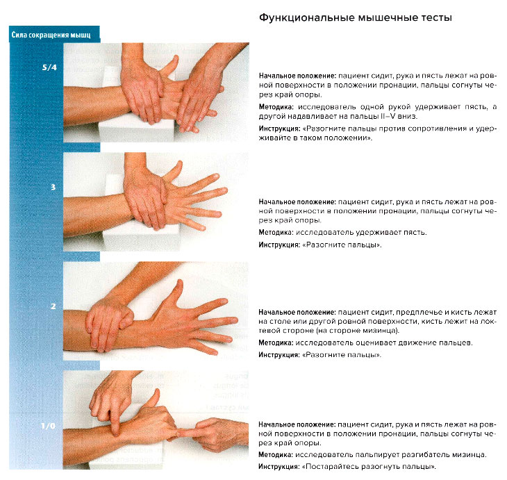 Функциональные мышечные тесты