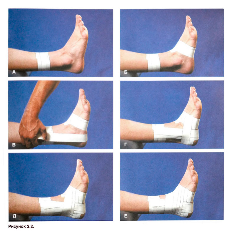 Файл:Ris 2 2.jpg