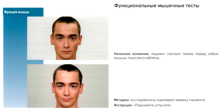 Функциональные мышечные тесты