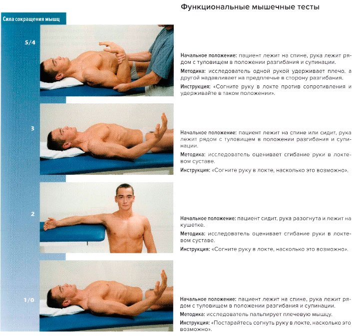 Функциональные мышечные тесты