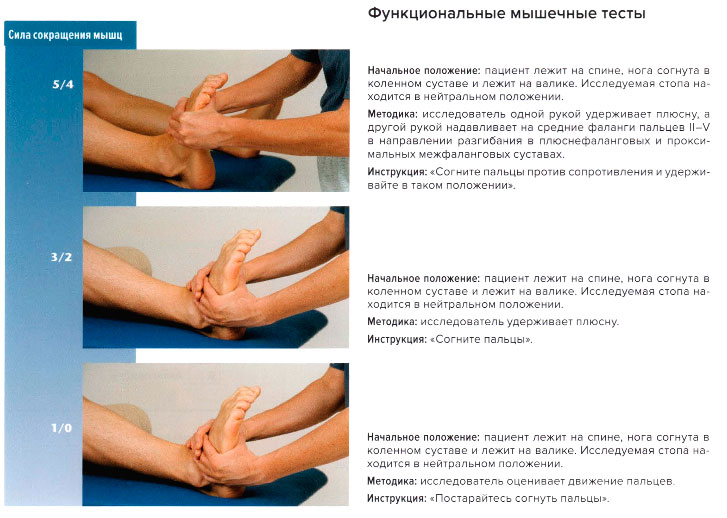 Функциональные мышечные тесты