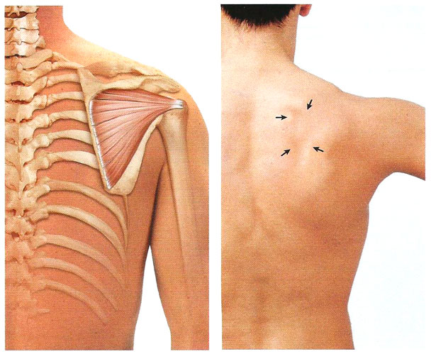 Файл:Mishci sport27.jpg