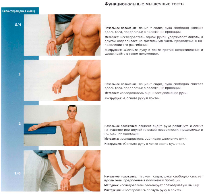 Функциональные мышечные тесты