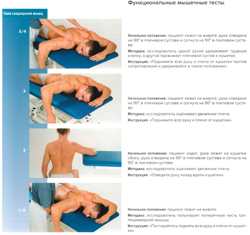 Функциональные мышечные тесты