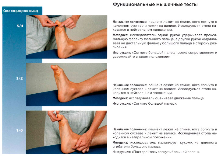 Функциональные мышечные тесты