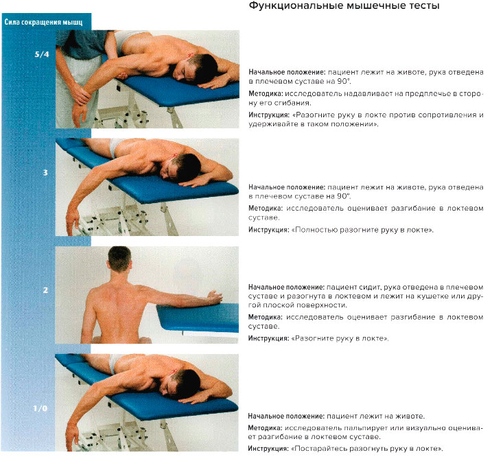Функциональные мышечные тесты