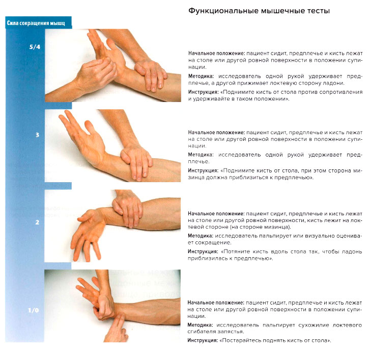 Функциональные мышечные тесты