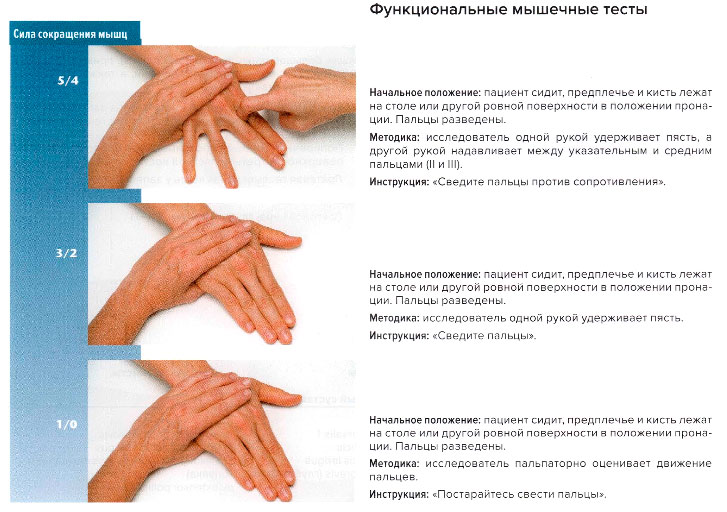 Функциональные мышечные тесты