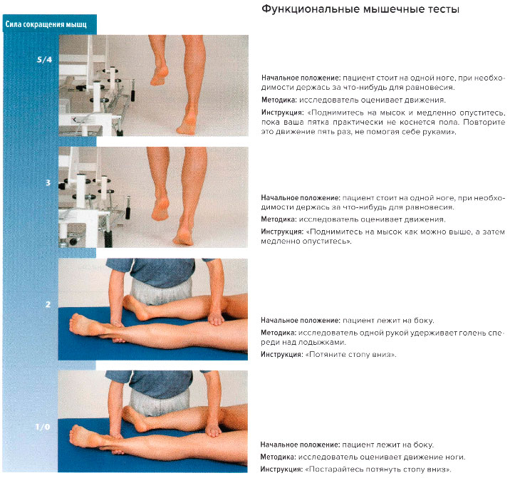 Функциональные мышечные тесты