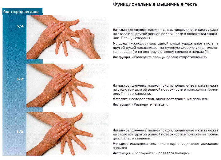 Функциональные мышечные тесты