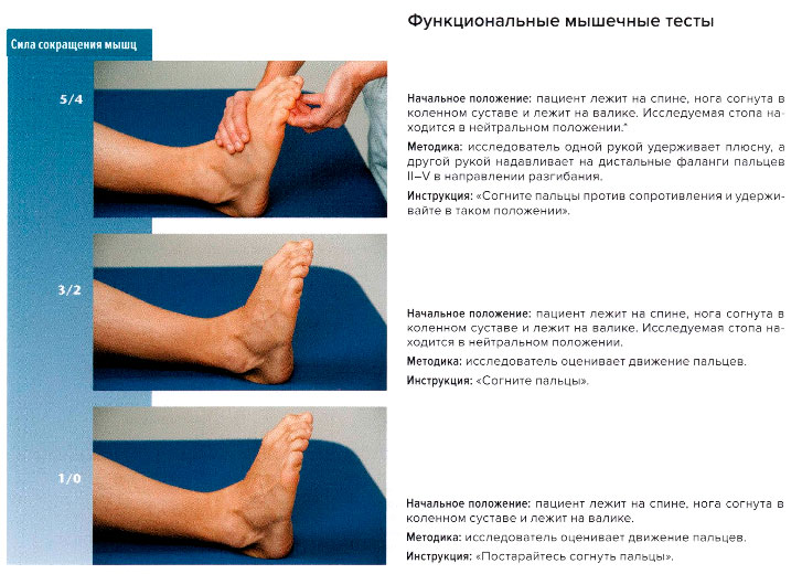Функциональные мышечные тесты